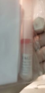 Enlightening the advancements in electrochemical bioanalysis for the diagnosis of Alzheimer's disease and other neurodegenerative disorders